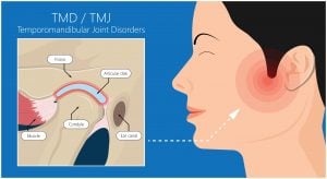 tmj surgery services texas